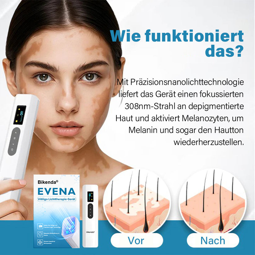 Bikenda® EVENA EXTRA Vitiligo-Lichttherapiegerät