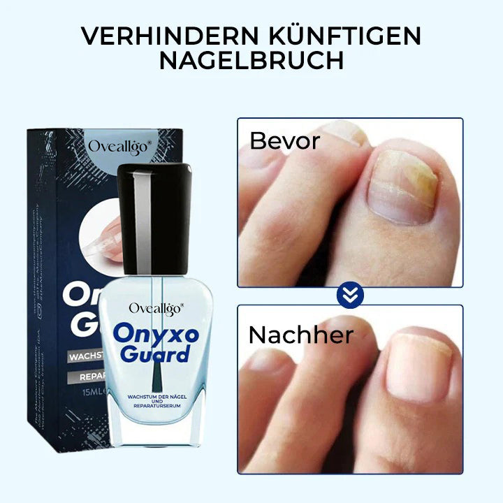 Oveallgo® OnyxoGuard ULTRA Wachstum der Nägel und Reparaturserum