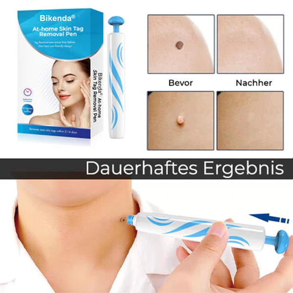 Bikenda® Stift zur Entfernung von Hautmarkierungen zu Hause
