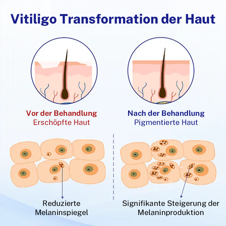 Oveallgo® Extra Evenora Kräuterspray