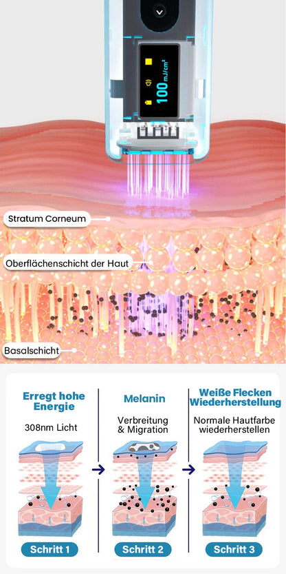 Bikenda® EVENA Profi Vitiligo Lichttherapie Gerät