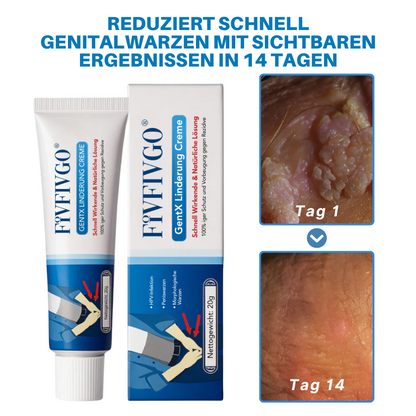 Fivfivgo® HPV-Creme ULTRA zur Linderung genitaler Warzen
