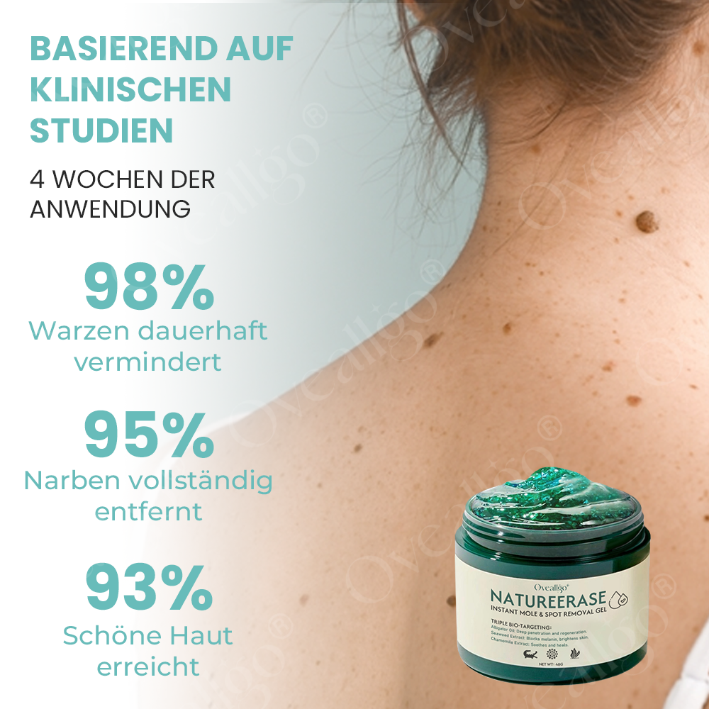 ✅ Offizieller Laden: Oveallgo® NatureErase Pro Gel zur sofortigen Entfernung von Muttermalen und Flecken