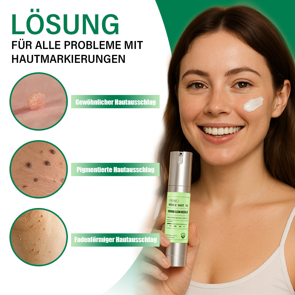 Oveallgo® Koreanisches DermaClear Reedle Shot 100 Serum zum Entfernen von Warzen und Muttermalen