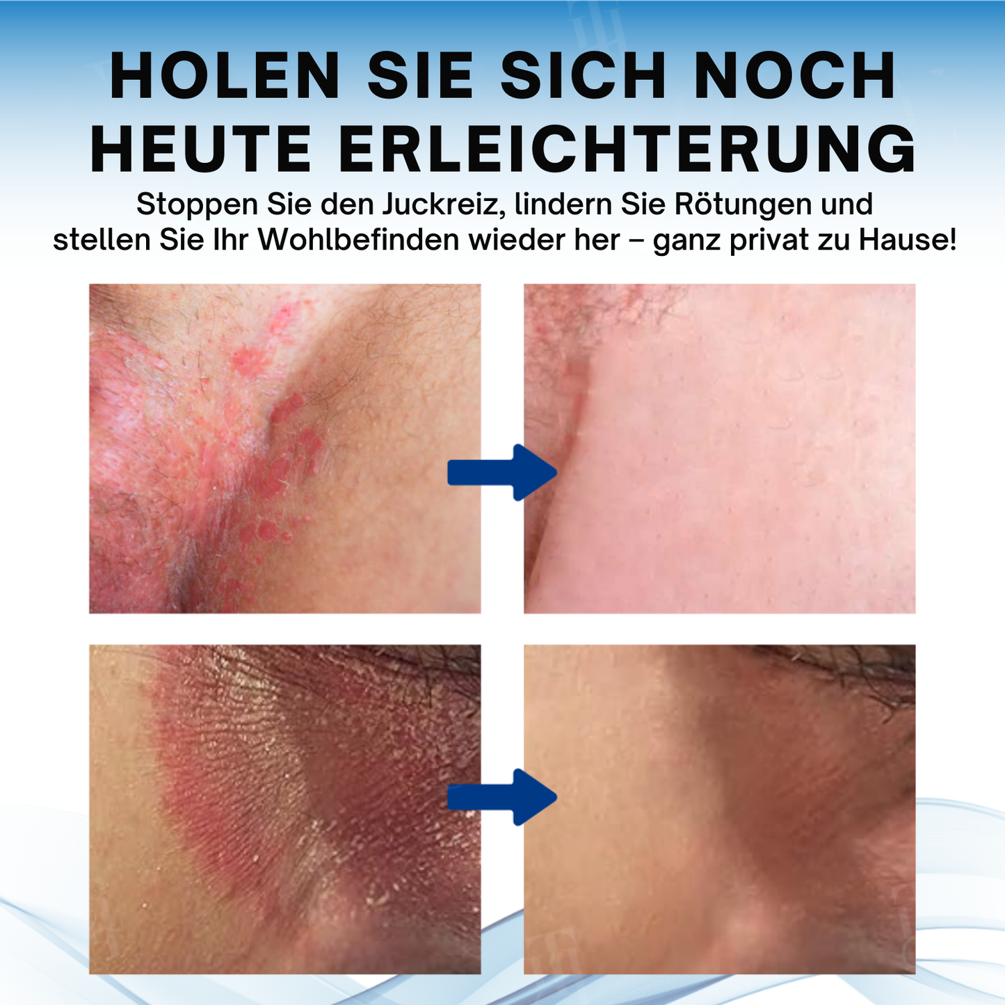 Fivfivgo® ACTIV Hodensack juckt Behandlungscreme