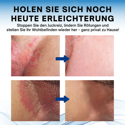 Fivfivgo® ACTIV Hodensack juckt Behandlungscreme