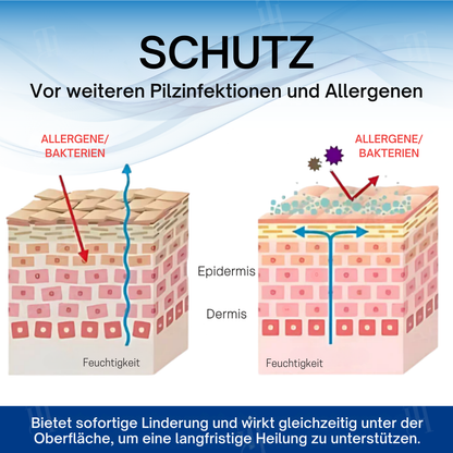 Fivfivgo® ACTIV Hodensack juckt Behandlungscreme