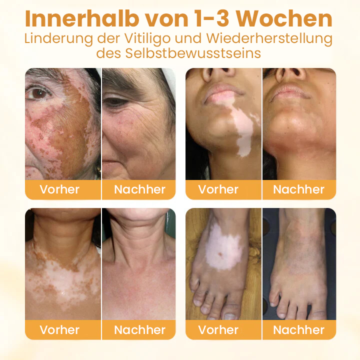 Oveallgo® Exklusiv Bienengift-Beruhigungscreme