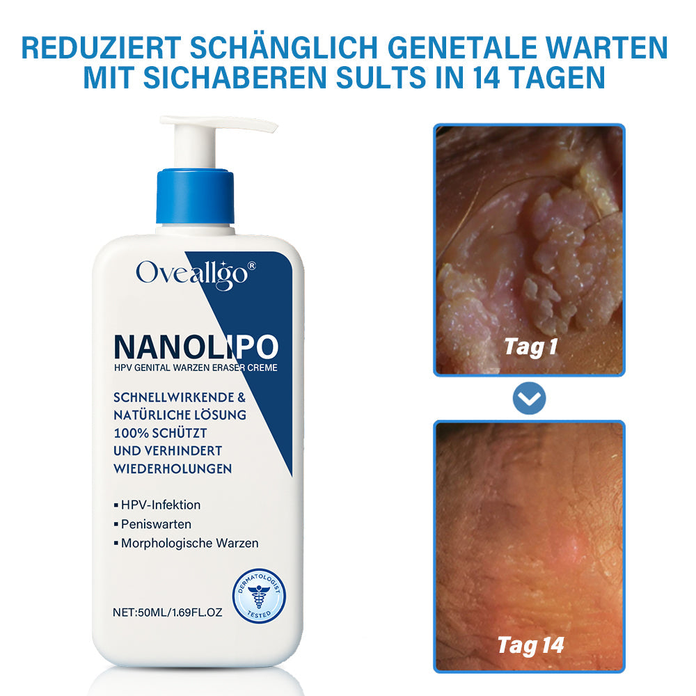 Oveallgo® ULTRA NanoLipo HPV Genital warzen-Eraser creme