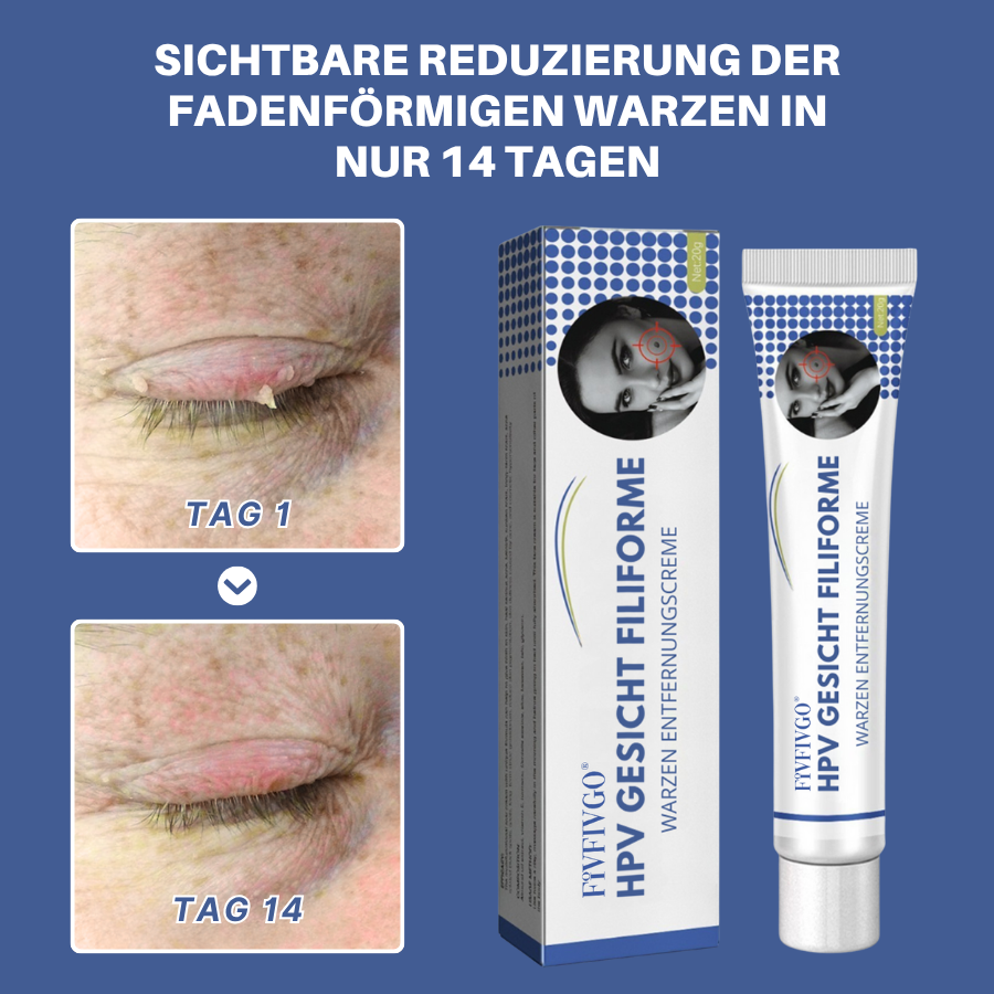 Fivfivgo® HPV Gesicht Filiforme Warzen Entfernungscreme