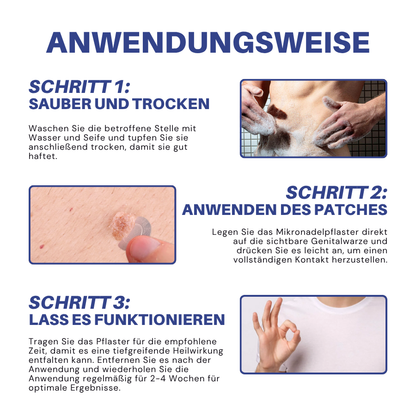 Fivfivgo® Mikronadel HPV Genitalien Warzen Entfernung Patch