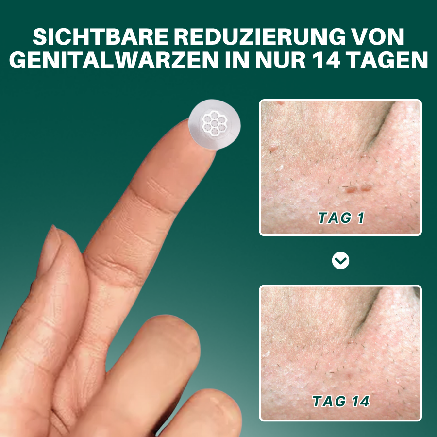 Fivfivgo® Magnesium ULTRA Mikropin HPV Genitalien Warzen Entfernung Patch