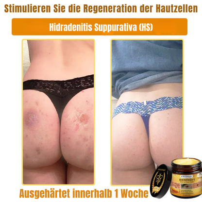 Fivfivgo® Bienengift Alles-in-Einem Creme