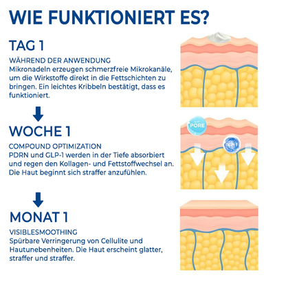 Oveallgo® PDRN-GLP-1 Abnehmen & Blutzucker Regulierung der nasalen Inhalation