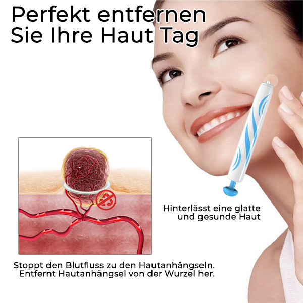 Bikenda® PRO Stift zur Entfernung von Hautmarkierungen zu Hause