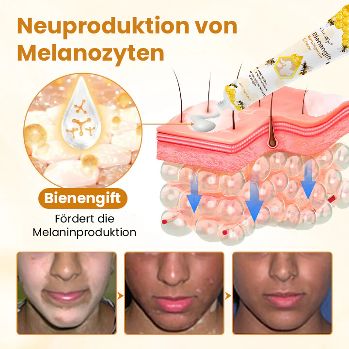 Oveallgo® Exklusiv Bienengift-Beruhigungscreme