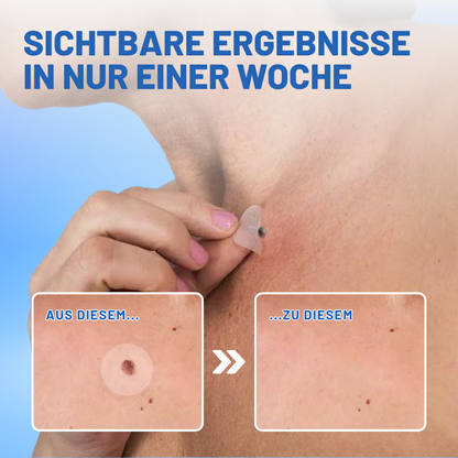 Fivfivgo® Muttermale & Warzen entfernen Haut Tag Patch