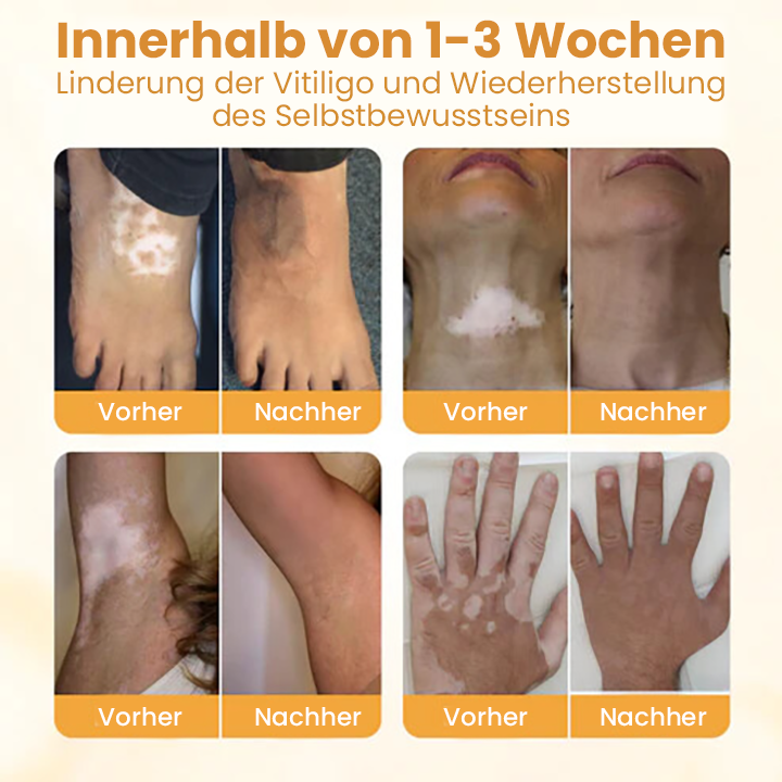 Oveallgo® Exklusiv Bienengift-Beruhigungscreme