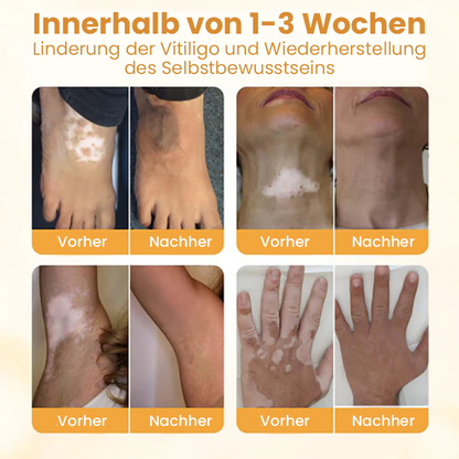 Oveallgo® Exklusiv Bienengift-Beruhigungscreme