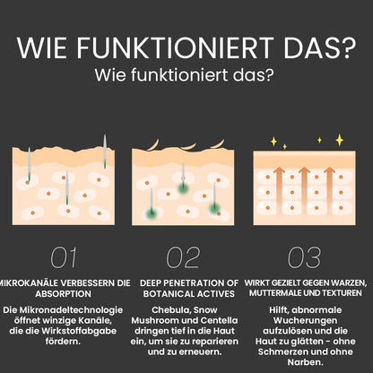 Oveallgo® Koreanisches DermaClear Reedle Shot 100 Serum zum Entfernen von Warzen und Muttermalen