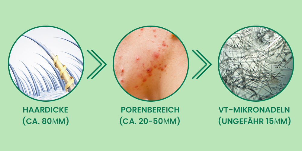 Oveallgo® Koreanisches DermaClear Reedle Shot 100 Serum zum Entfernen von Warzen und Muttermalen