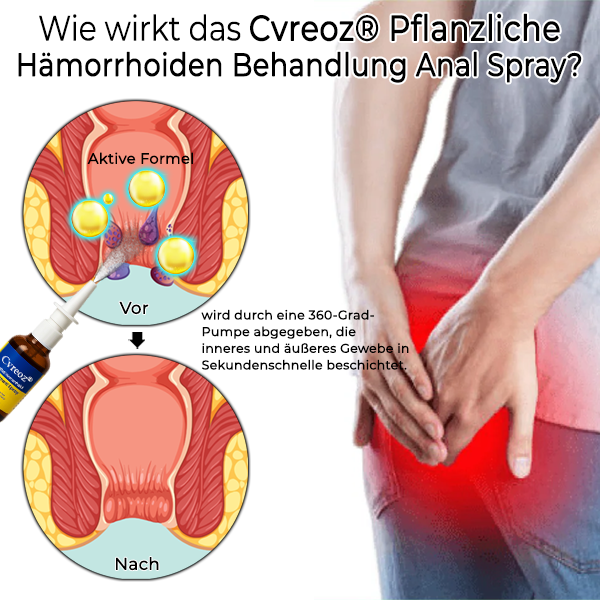 Cvreoz® Erweiterte Pflanzliche Hämorrhoiden Behandlung Anal Spray