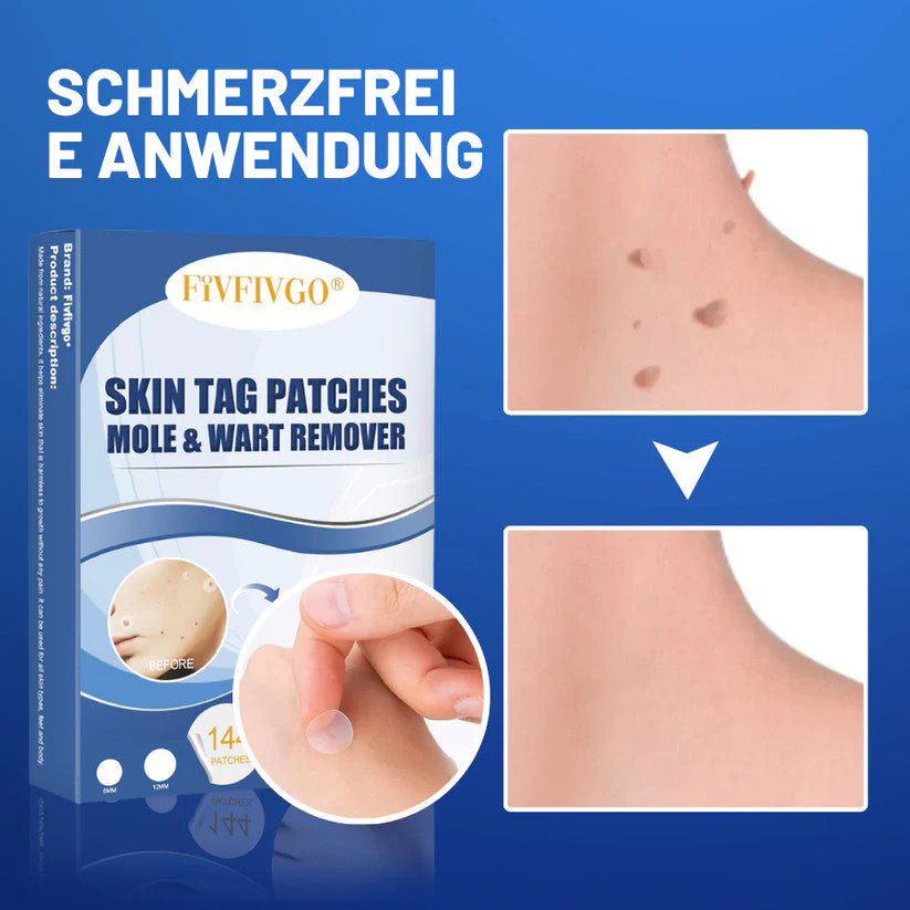 Fivfivgo® Muttermale & Warzen entfernen Haut Tag Patch