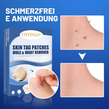 Fivfivgo® Muttermale & Warzen entfernen Haut Tag Patch