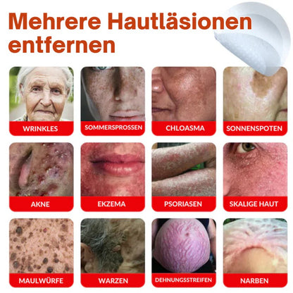 Oveallgo® PROFI MikroNadel Botanisches Tag-Clear-Pflaster 🇩🇪 Hergestellt in der Germany