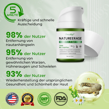 ✅ Offizieller Laden: Oveallgo® NatureErase Sofort Maulwurf & Flecken-Creme