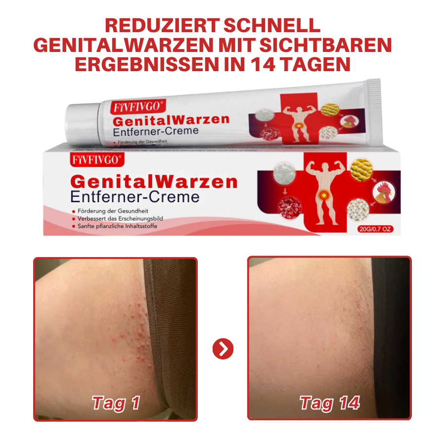 Fivfivgo® FloraGuard HPV Genitalwarzen-Entferner