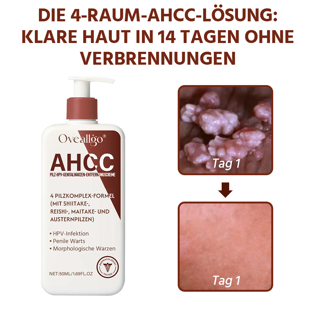 Oveallgo® AHCC Fungal HPV Genital Warts Removal Cream image Oveallgo® AHCC Fungal HPV Genital Warts Removal Cream