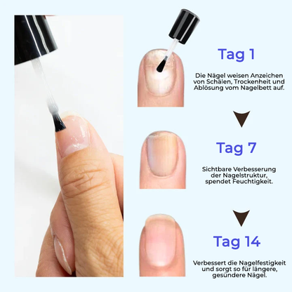 Oveallgo® OnyxoGuard ULTRA Wachstum der Nägel und Reparaturserum
