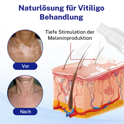 Oveallgo® Evenora Kräuterspray