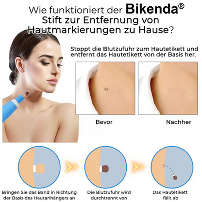 Bikenda® PRO Stift zur Entfernung von Hautmarkierungen zu Hause
