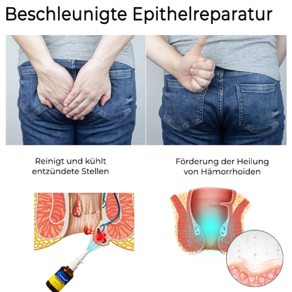Cvreoz® Erweiterte Pflanzliche Hämorrhoiden Behandlung Anal Spray