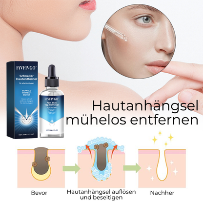 Fivfivgo® Schneller Hautentferner für alle Hauttypen