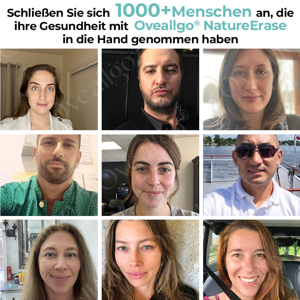 ✅ Offizieller Laden: Oveallgo® NatureErase Pro Gel zur sofortigen Entfernung von Muttermalen und Flecken