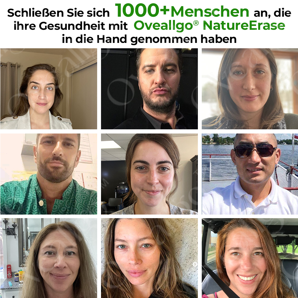 ✅ Offizieller Laden: Oveallgo® NatureErase Sofort Maulwurf & Flecken-Creme