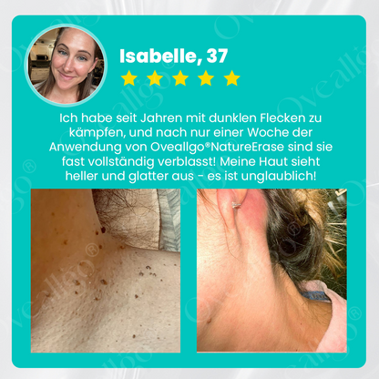 ✅ Offizieller Laden: Oveallgo® NatureErase Pro Gel zur sofortigen Entfernung von Muttermalen und Flecken