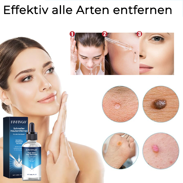 Fivfivgo® Schneller Hautentferner für alle Hauttypen