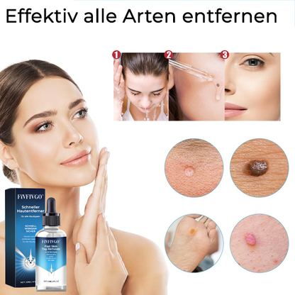 Fivfivgo® Schneller Hautentferner für alle Hauttypen
