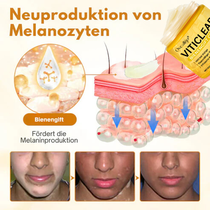 Oveallgo® VitiClear Elite Bienengift Creme