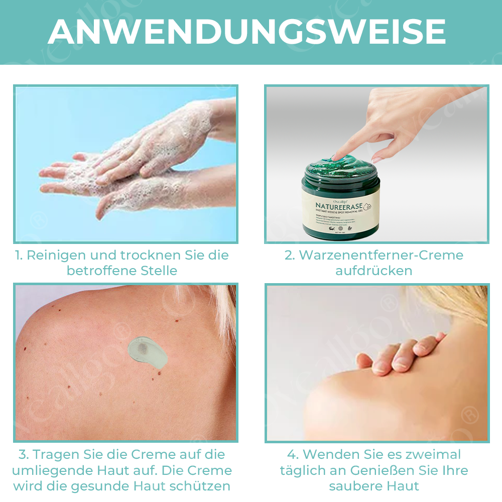 ✅ Offizieller Laden: Oveallgo® NatureErase Pro Gel zur sofortigen Entfernung von Muttermalen und Flecken