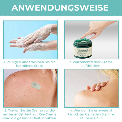 ✅ Offizieller Laden: Oveallgo® NatureErase Pro Gel zur sofortigen Entfernung von Muttermalen und Flecken