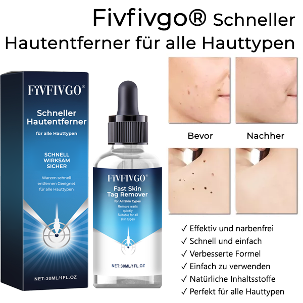 Fivfivgo® Schneller Hautentferner für alle Hauttypen