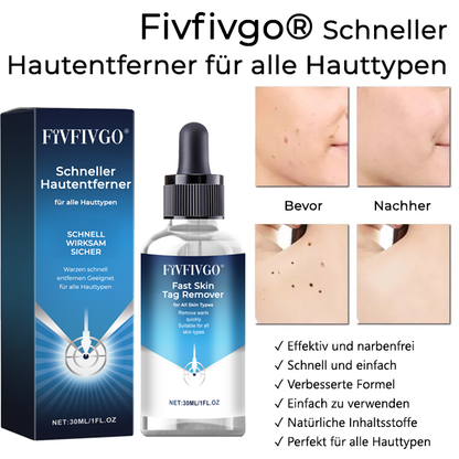 Fivfivgo® Schneller Hautentferner für alle Hauttypen