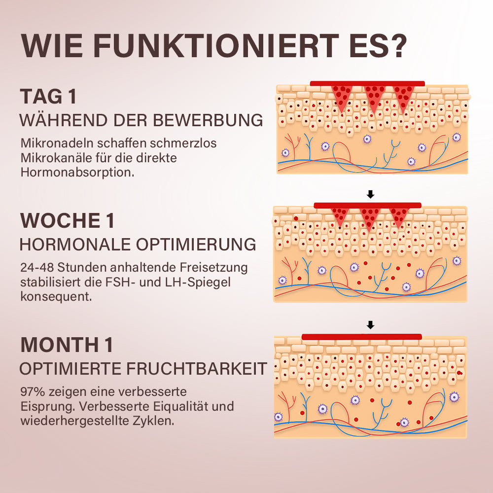 Oveallgo® FertiliPatch Profi Mikronadel-System zur Steigerung der Fruchtbarkeit