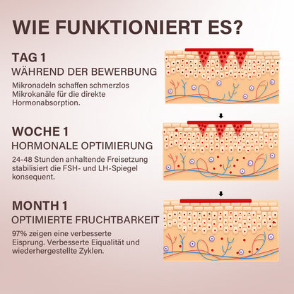 Oveallgo® FertiliPatch Profi Mikronadel-System zur Steigerung der Fruchtbarkeit