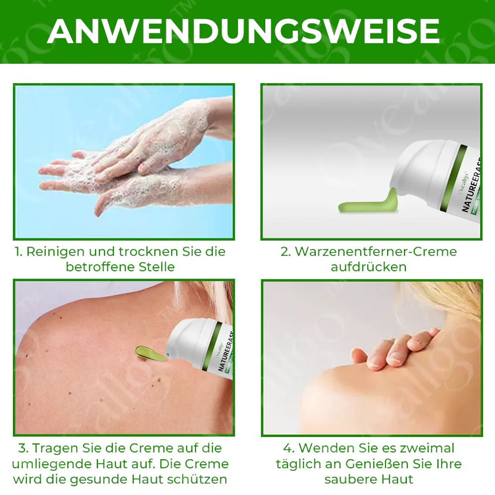 ✅ Offizieller Laden: Oveallgo® NatureErase Sofort Maulwurf & Flecken-Creme